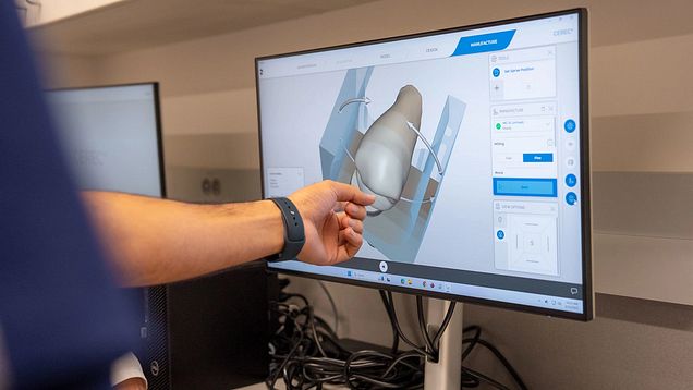 Tooth model on monitor